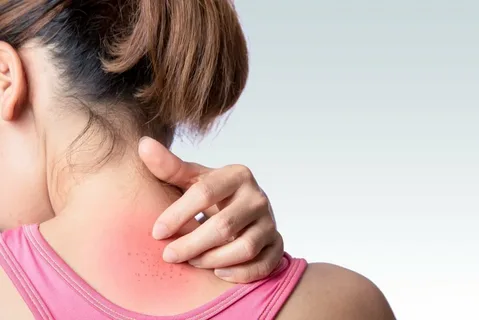 Skin Infections and Irritations